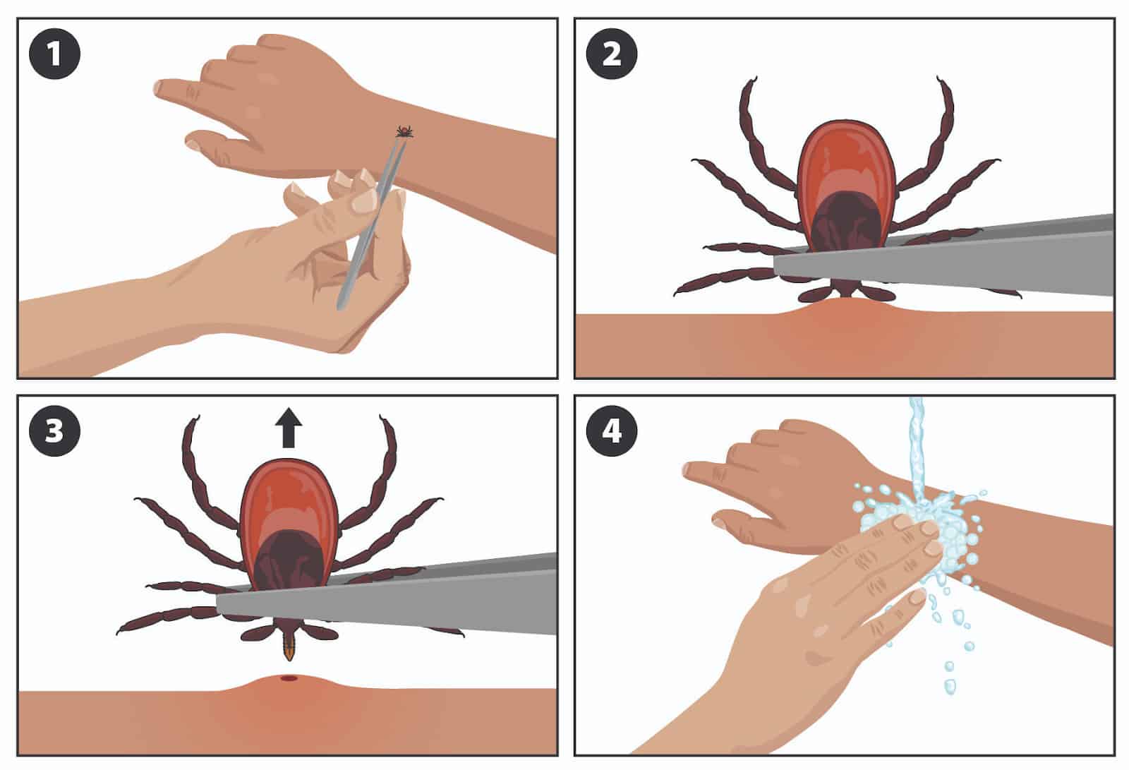 LCHD: How to prevent tick bites, identify disease symptoms, remove ticks